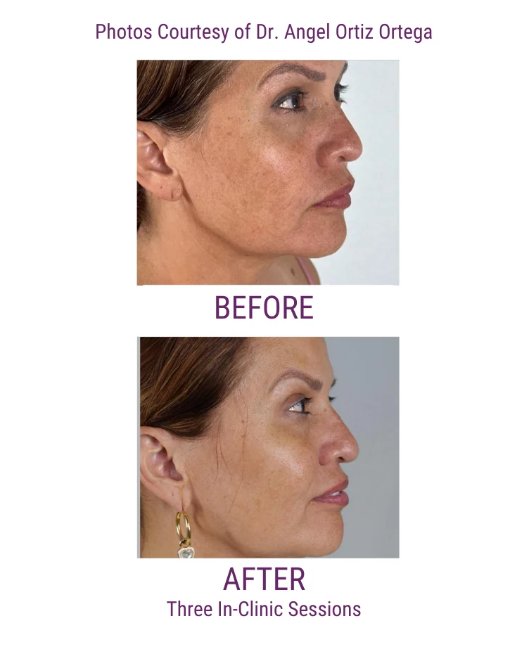 Skin Health System Results Dr Ortiz Skin Health System Results Dr Ortiz