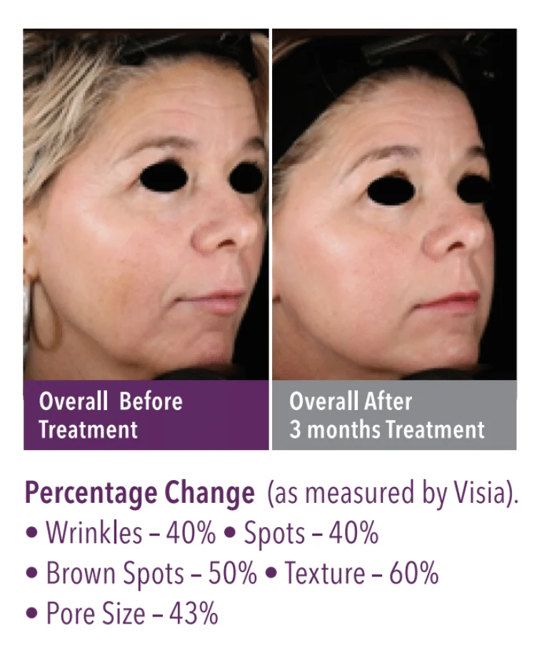 SkinGenuity Overall Treatment