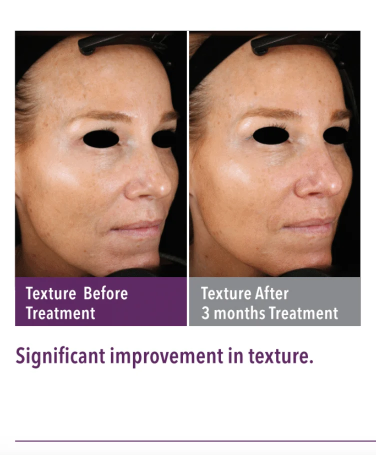 SkinGenuity Texture Skin Health Texture
